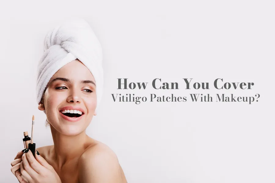 how to cover vitiligo patches with makeup